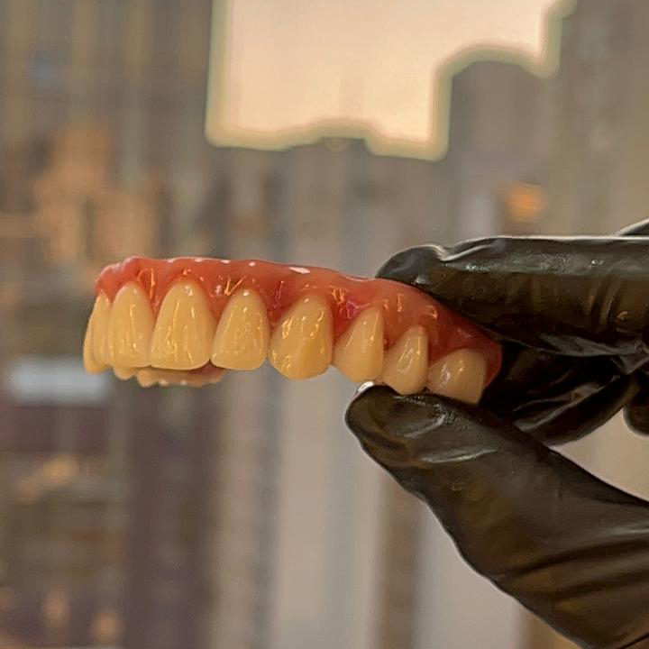 Implantes Dentários